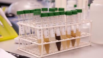 ©EarlhamInstitute-Michelle-Grey-fungi-2025-16